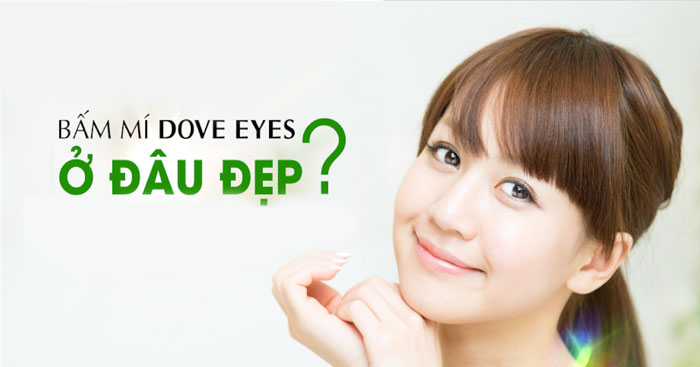 Bấm Mí Mắt Dove Eyes - Tạo Mắt 2 Mí - Không Cần Phẫu Thuật