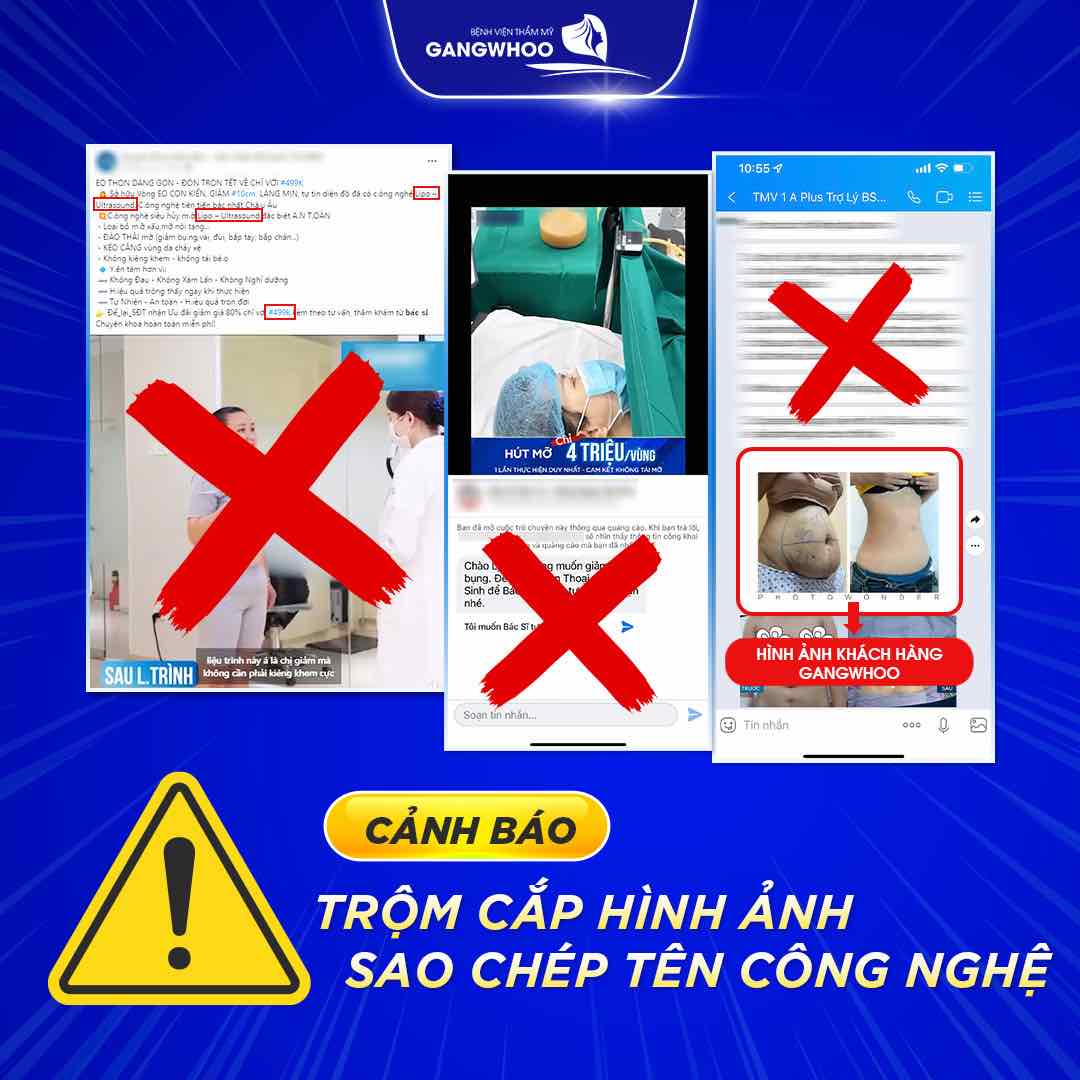 Cảnh báo giả mạo BVTM Gangwhoo để lừa đảo khách hàng