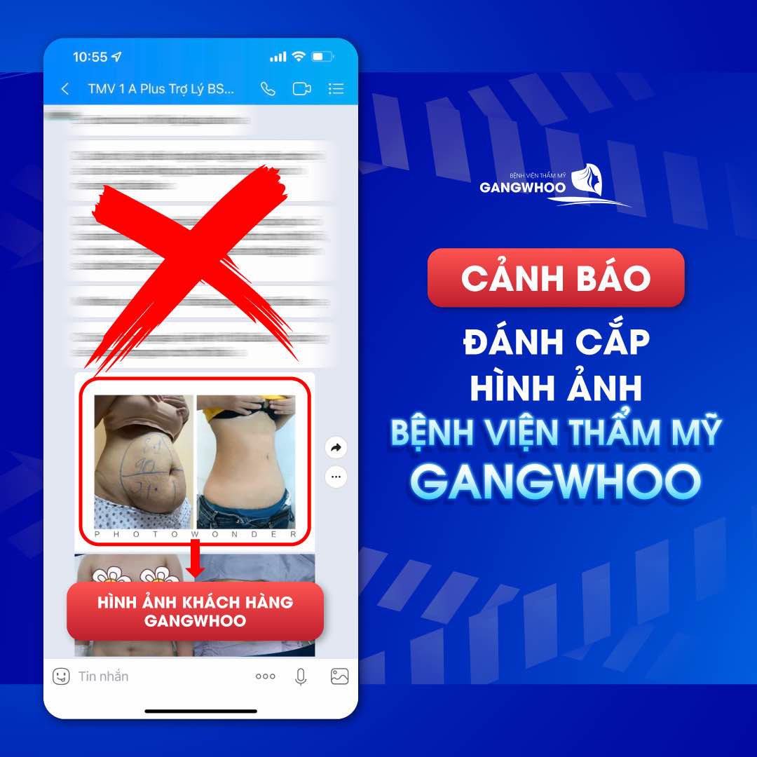 Tự ý sử dụng hình ảnh khách hàng của Gangwhoo để chèo kéo làm dịch vụ