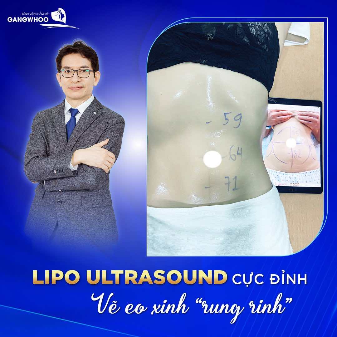 Giảm mỡ nhẹ tênh là nhờ công nghệ hút mỡ hiện đại Lipo Ultrasound