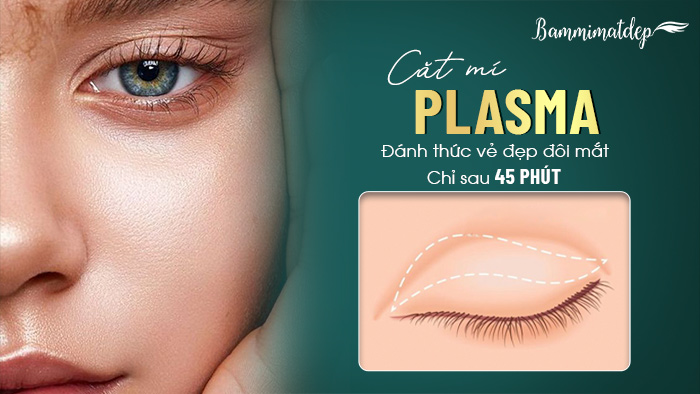 Cắt mí Plasma là phương pháp thẩm mỹ mắt sử dụng dao chuyên dụng Plasma tạo đường nếp mí